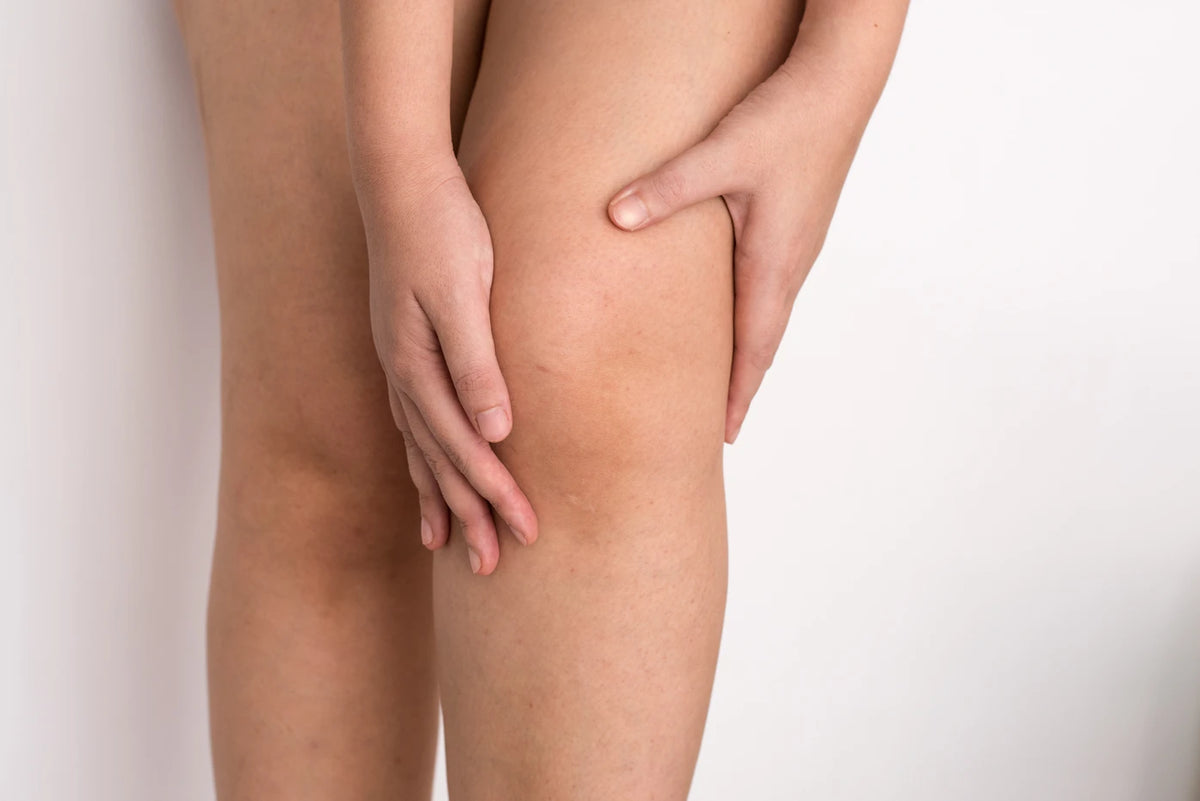 ¡Combate la celulitis con la naturaleza!